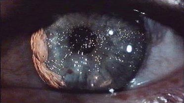 eye2.jpg
